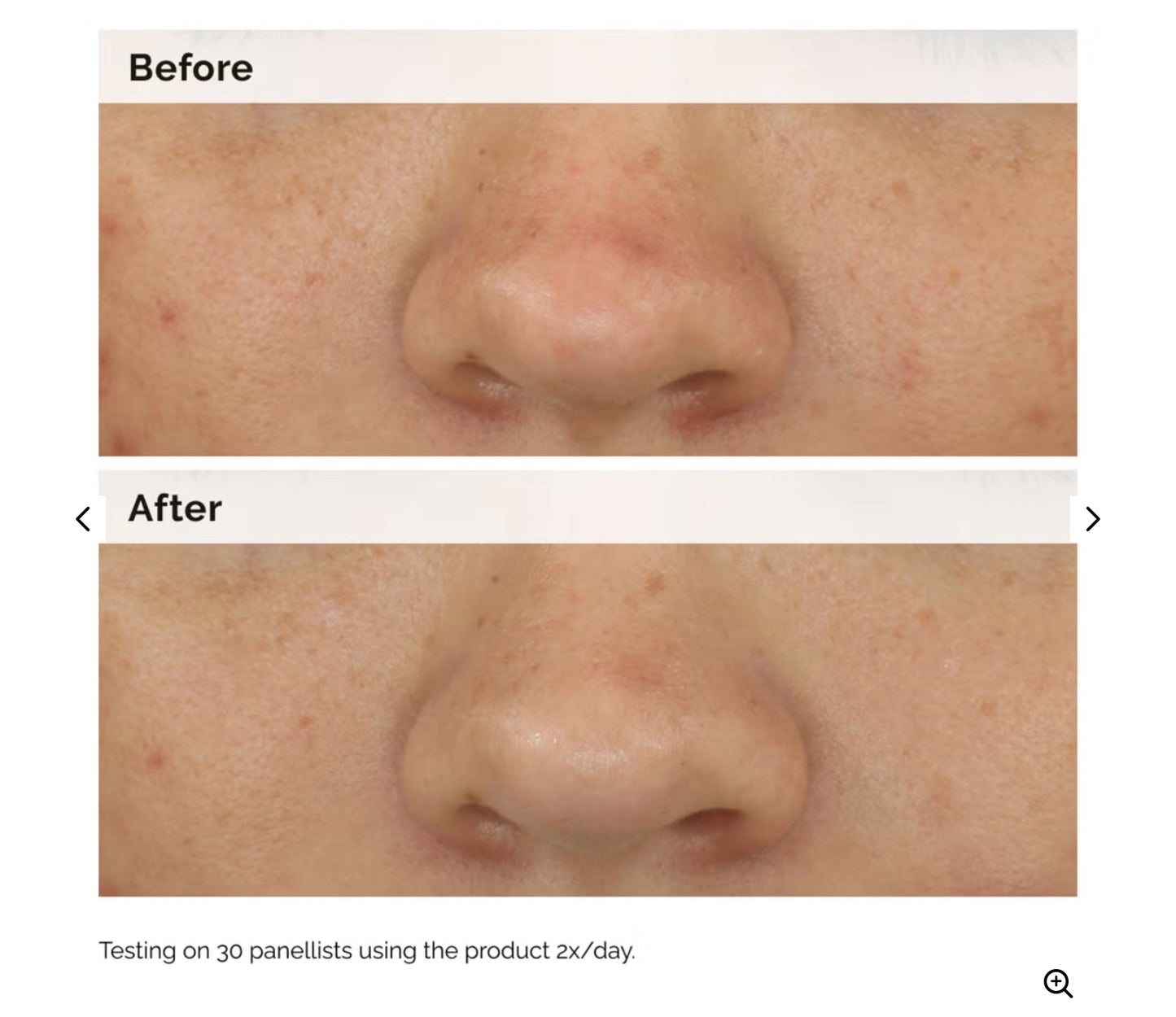 سيروم موازن ومنقي