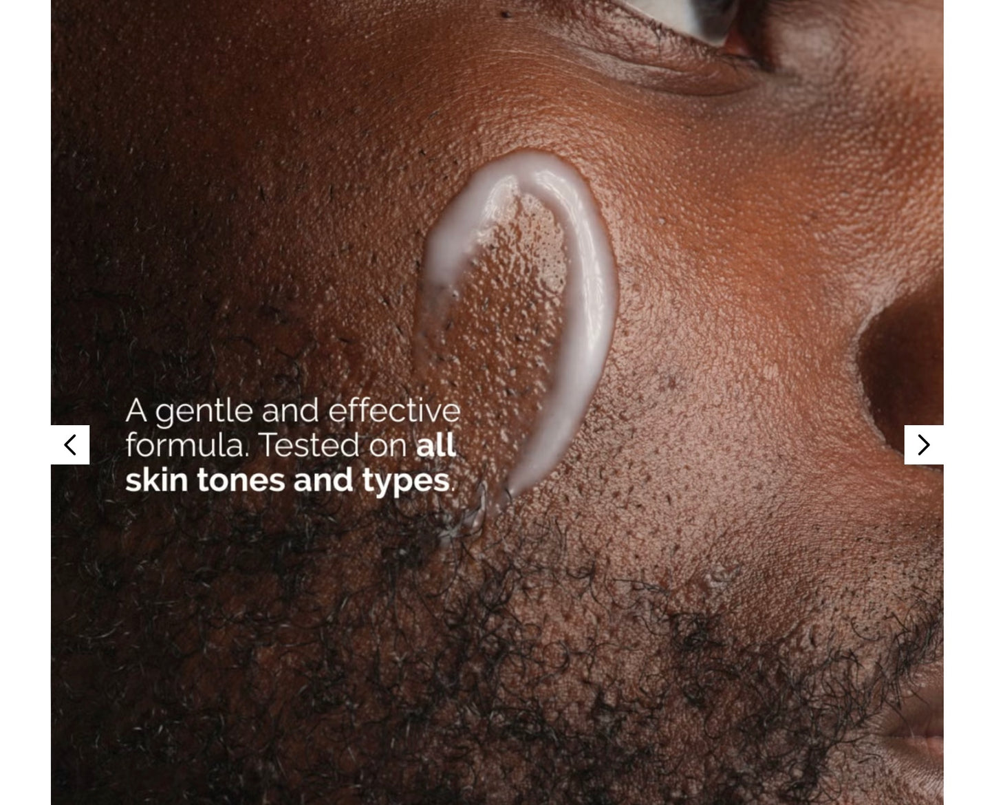 إيمولشن النياسيناميد 5% للوجه والجسم