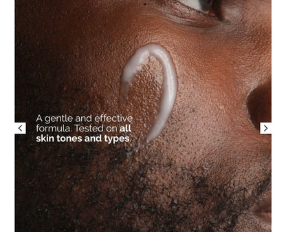 إيمولشن النياسيناميد 5% للوجه والجسم