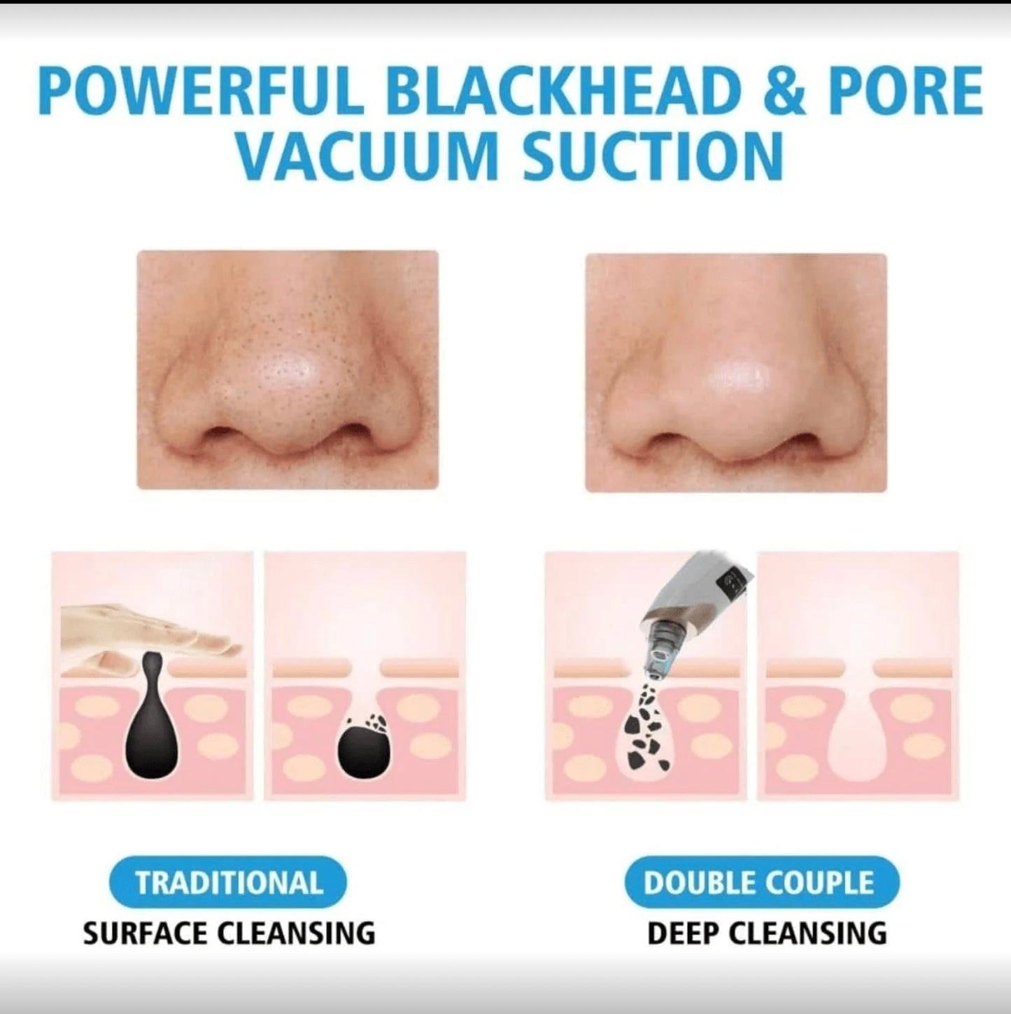 جهاز رائع للتخلص من الرؤوس السوداء و تنظيف الوجه
