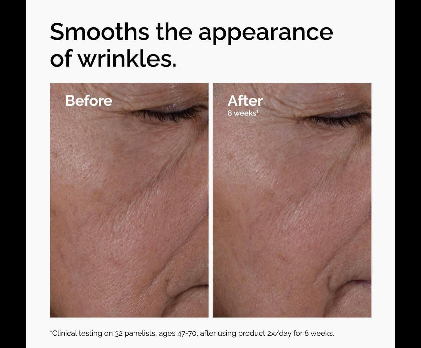 مجموعة شد البشرة من ذا اورديناري